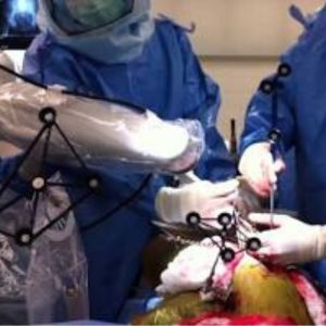 robotic hip replacement